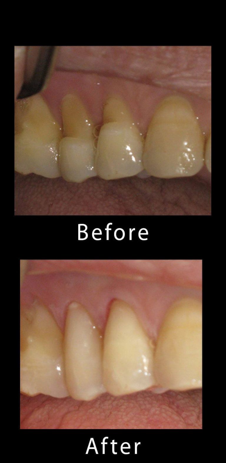 Before and After Dental Gallery Advanced Dental Arts